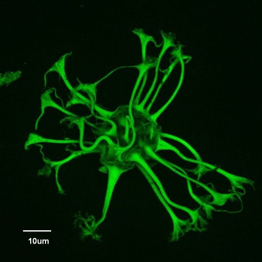 Dinoflagellate Dinoflagellate